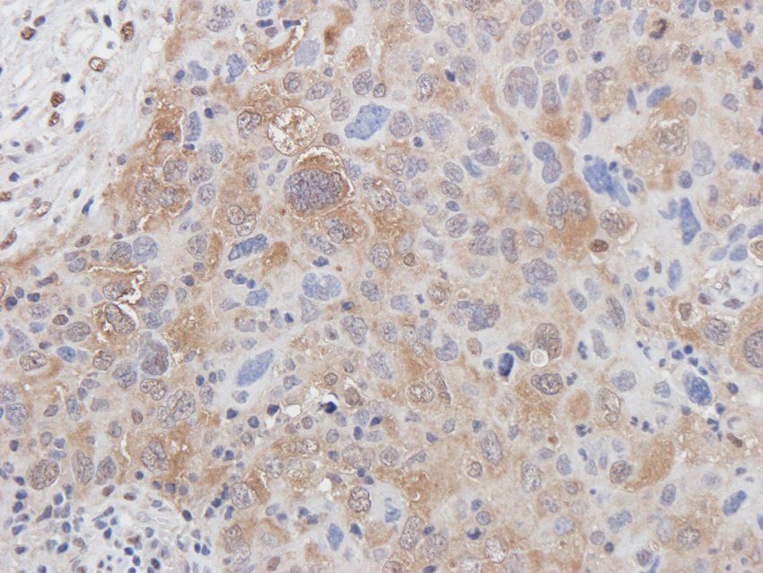 BMR1A Rabbit Polyclonal Antibody