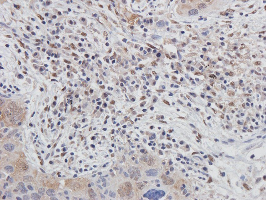 BMR1A Rabbit Polyclonal Antibody