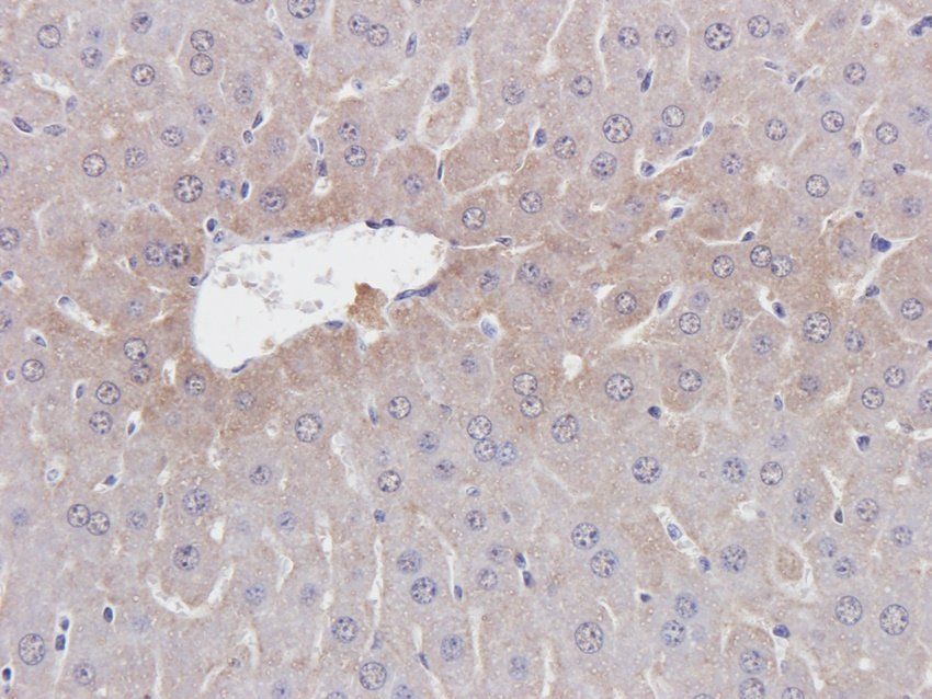 BMR1A Rabbit Polyclonal Antibody