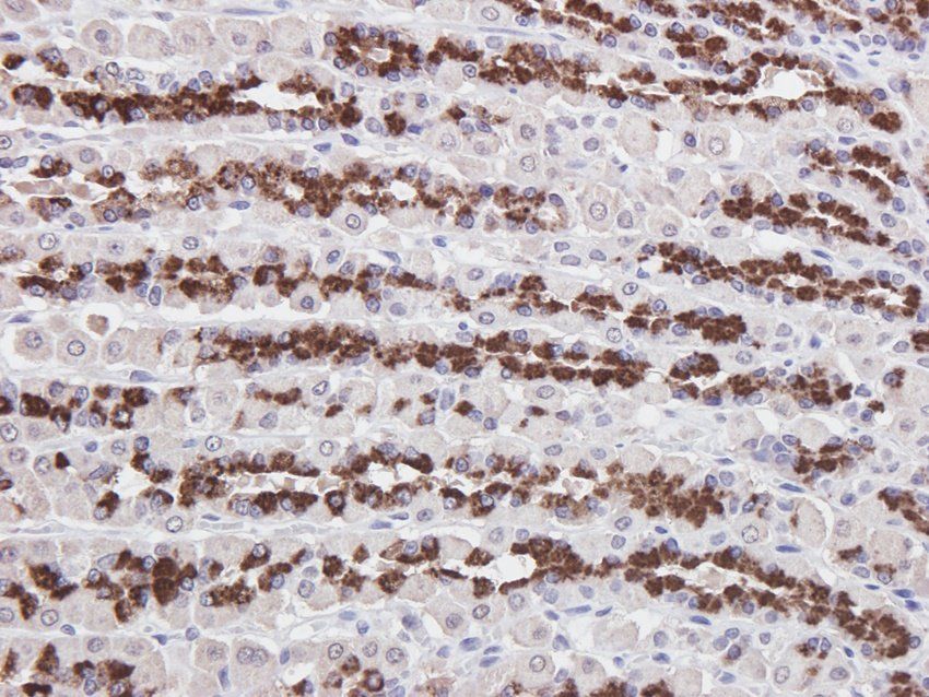 BMR1A Rabbit Polyclonal Antibody