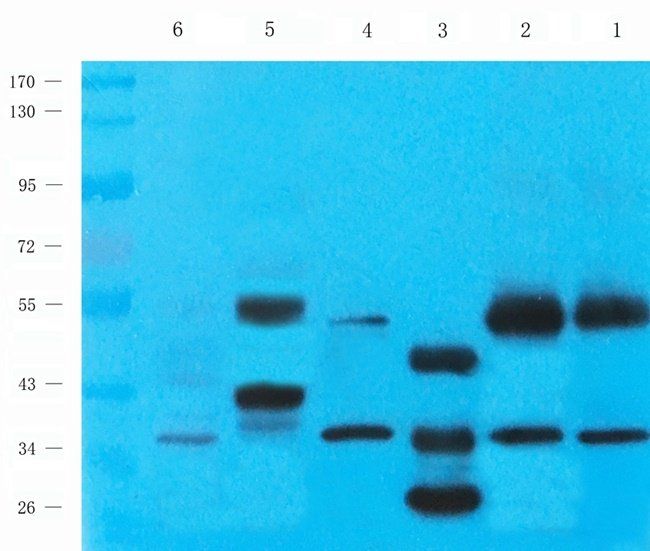 BMR1A Rabbit Polyclonal Antibody