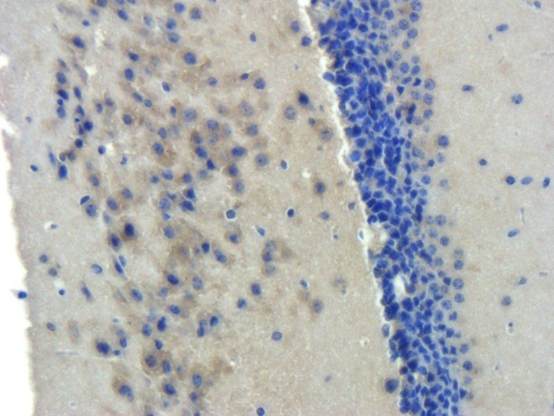 BMPR2 Rabbit Polyclonal Antibody