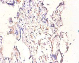 BMP6 Antibody