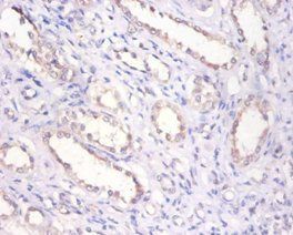 BMP6 Antibody
