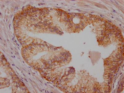 BRAF Antibody