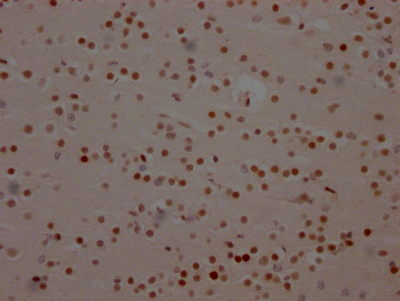 BRD4 Antibody
