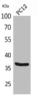 BST1 Antibody