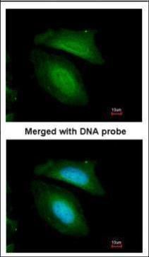 BZW2 Rabbit Polyclonal Antibody