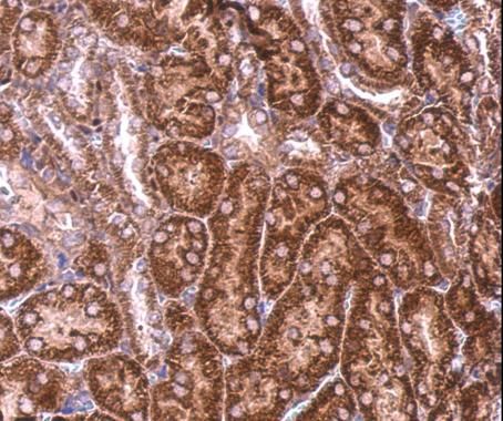 BZW2 Rabbit Polyclonal Antibody