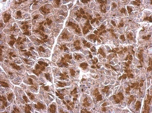 BZW2 Rabbit Polyclonal Antibody