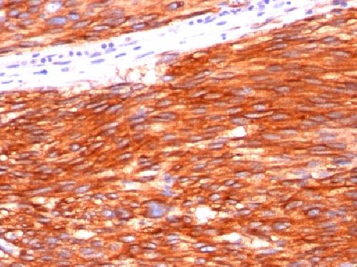 KIT Antibody