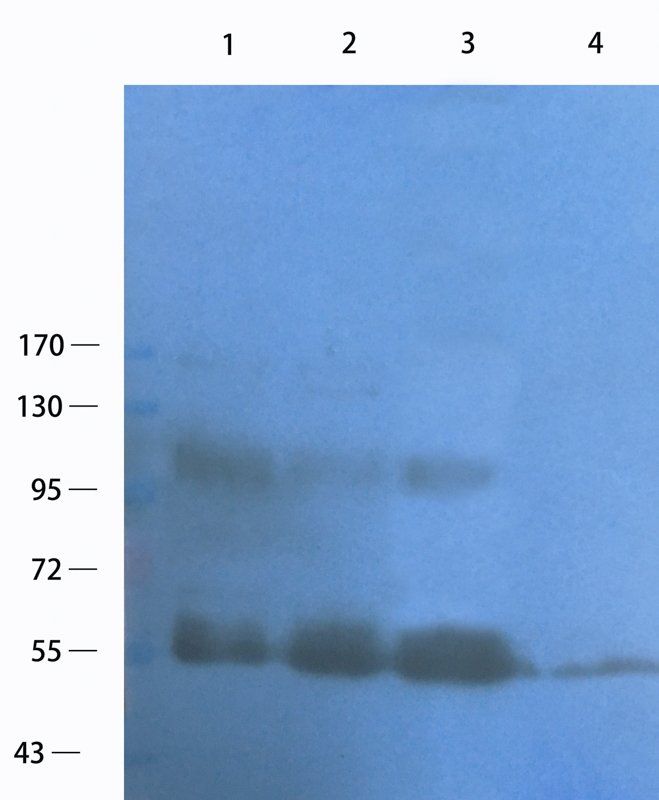 c-Kit Rabbit Polyclonal Antibody