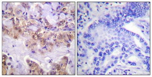 C-RAF (Phospho-Ser621) Antibody