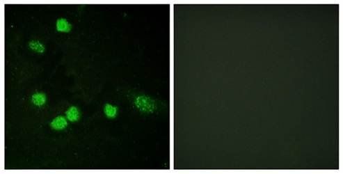 C-RAF (Ab-621) Antibody