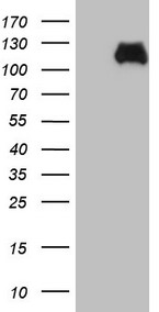 C Reactive Protein Antibody