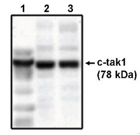 Sheep anti Human TAK1 Antibody
