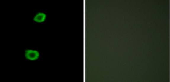 LMTK2 Antibody