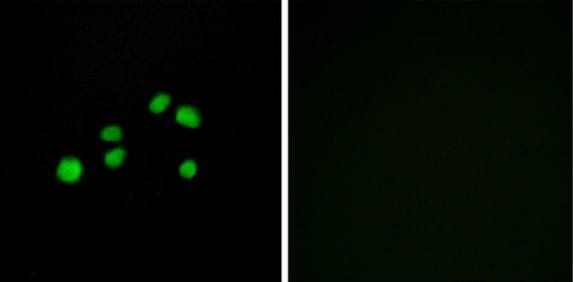 Collagen XXIII α1 Antibody