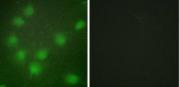 HOXA11/D11 Antibody