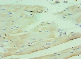 C1QB Antibody