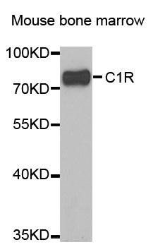C1R Rabbit Polyclonal Antibody