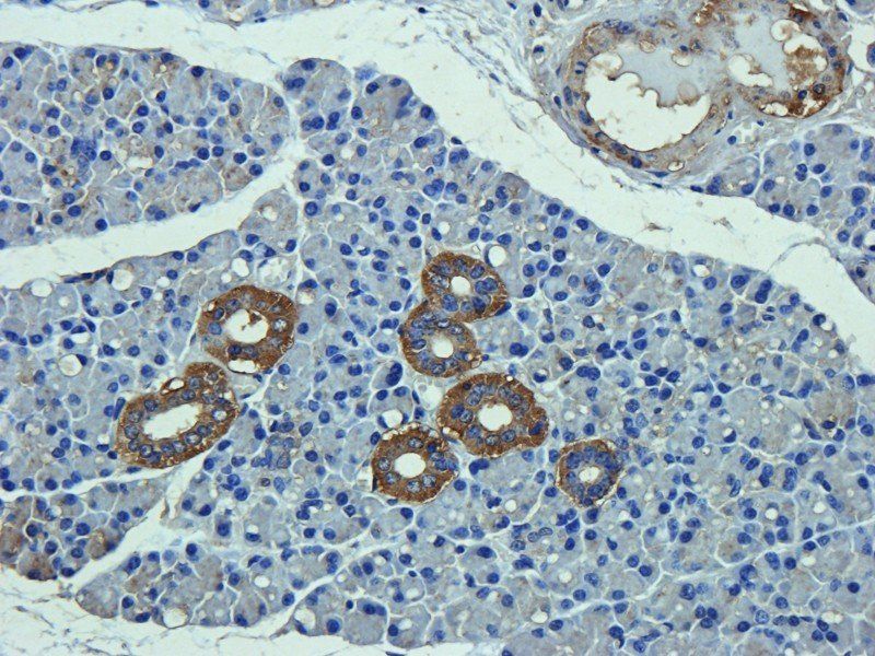C1R Rabbit Polyclonal Antibody
