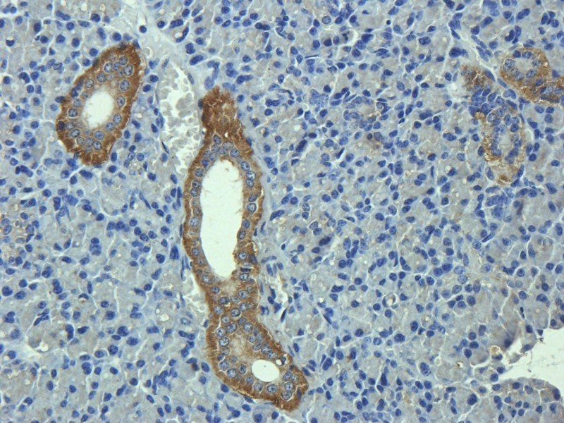 C1R Rabbit Polyclonal Antibody