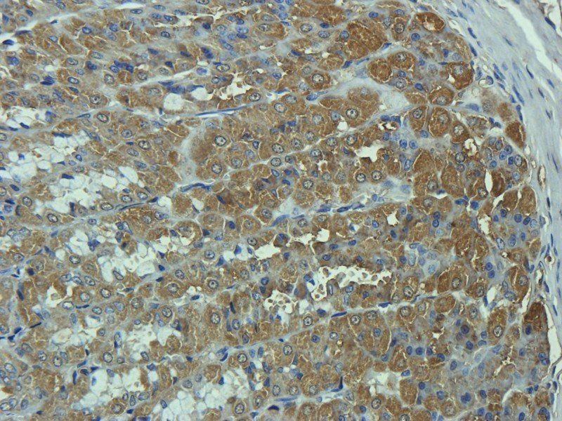 C1R Rabbit Polyclonal Antibody