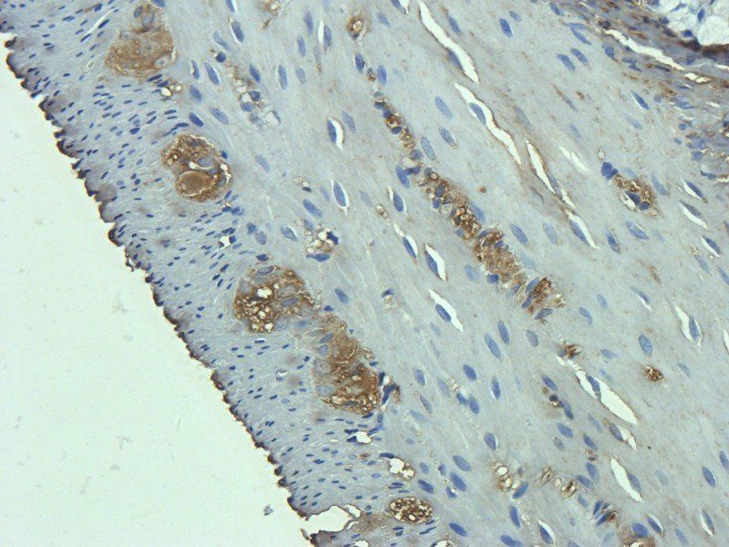 C1R Rabbit Polyclonal Antibody