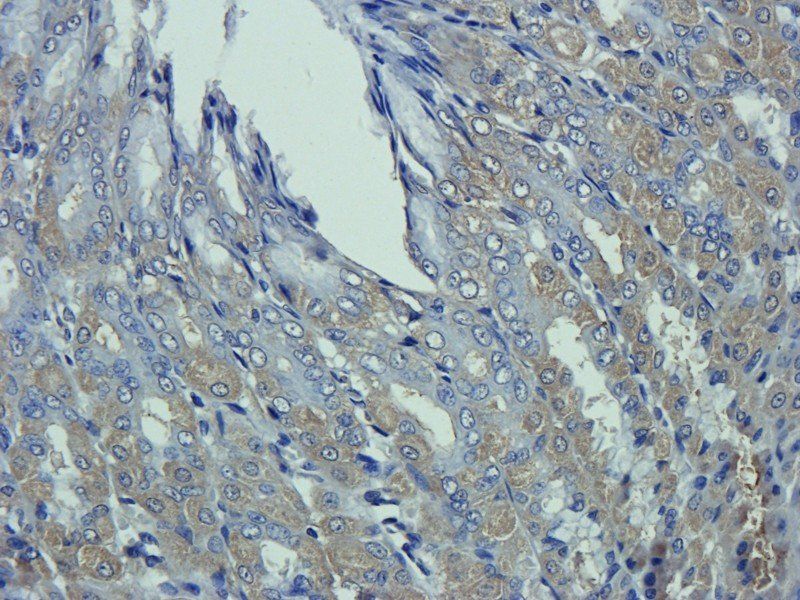 C1R Rabbit Polyclonal Antibody