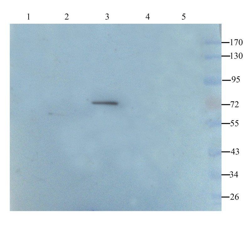 C1R Rabbit Polyclonal Antibody