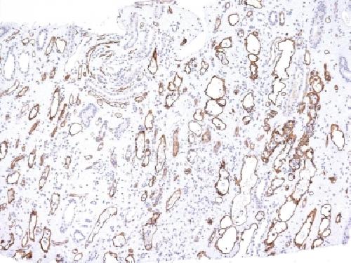 C4A, N/A Antibody