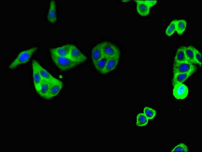 C5AR1 Antibody