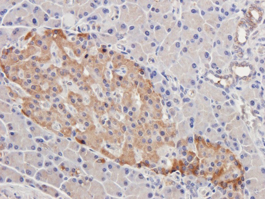 C5b-9 Rabbit Polyclonal Antibody