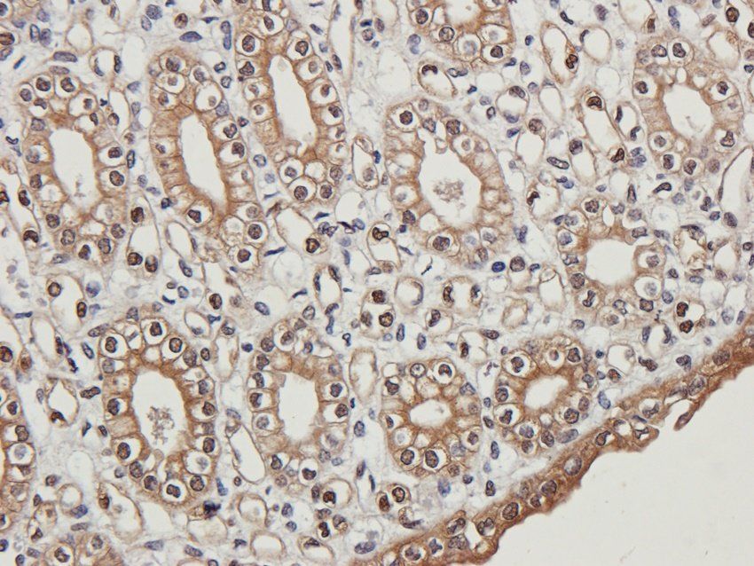 C5b-9 Rabbit Polyclonal Antibody