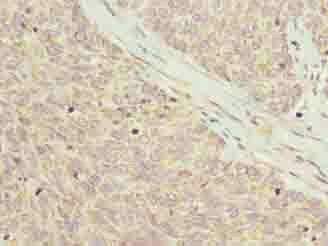 PPDPFL Antibody