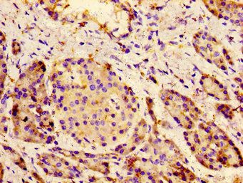 CACNA1C Antibody