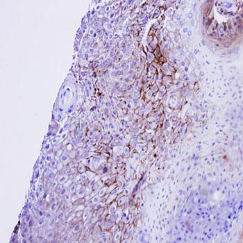 CACNA1S Rabbit Polyclonal Antibody