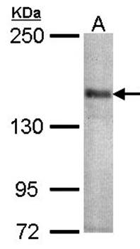 CACNA1S Rabbit Polyclonal Antibody