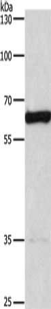 CACNB1 Antibody