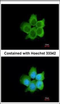 CacyBP Rabbit Polyclonal Antibody