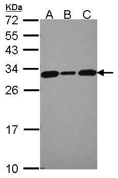 CacyBP Rabbit Polyclonal Antibody