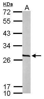 CacyBP Rabbit Polyclonal Antibody