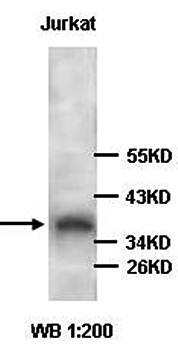 DFFA/ICAD Rabbit Polyclonal Antibody