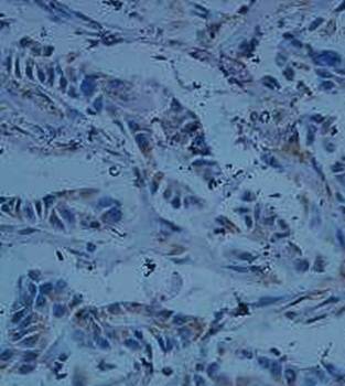 DFFA/ICAD Rabbit Polyclonal Antibody