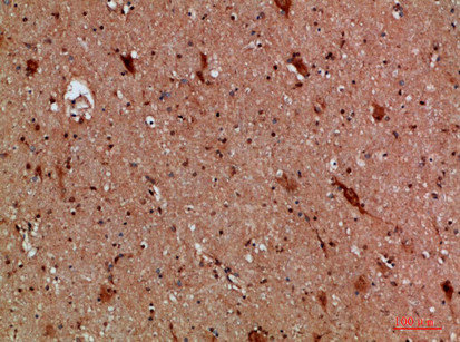 CALB2 Antibody