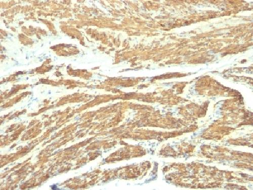 CALD1 Antibody