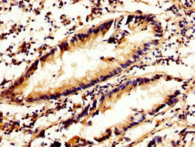 CAPN2 Antibody