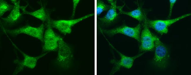 Calretinin Rabbit Polyclonal Antibody