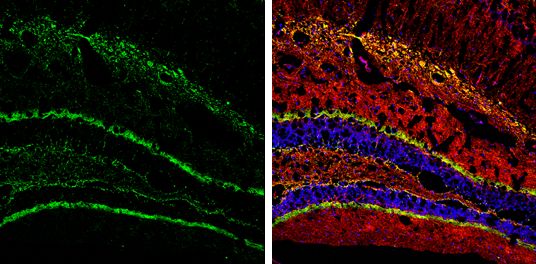 Calretinin Rabbit Polyclonal Antibody